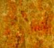 European red mite eggs (Bessin, UKY)